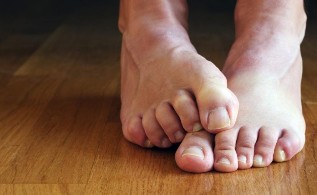 Causes of fungal nail