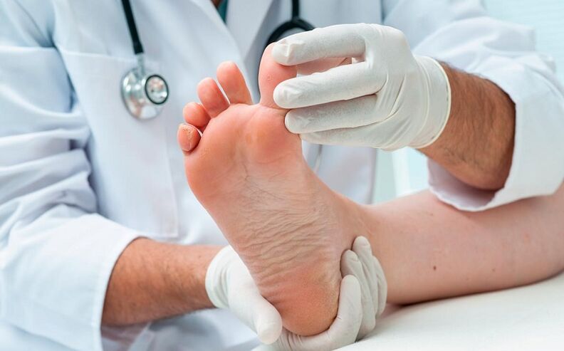 how and how to treat fungus on the feet