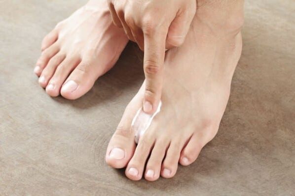 applying ointment from skin fungus on the feet