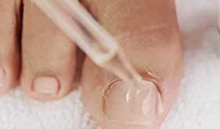 Drops for fungus of the toenails